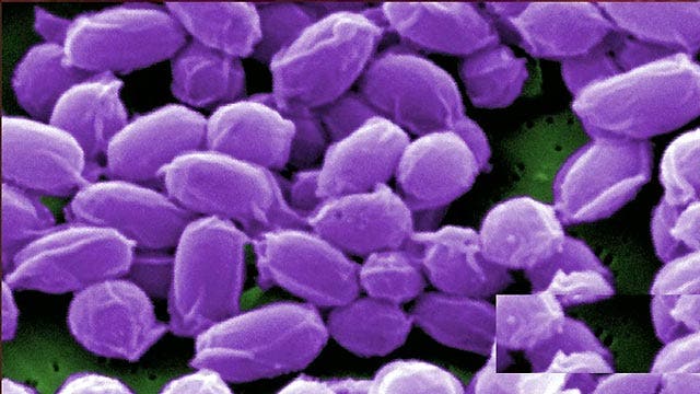 How live anthrax got loose at Center for Disease Control lab