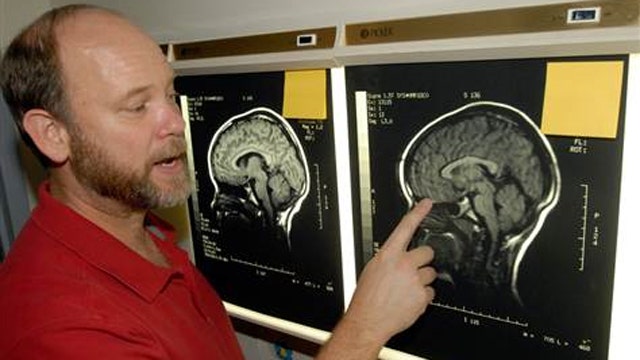 Study: Severe concussions in teens more common