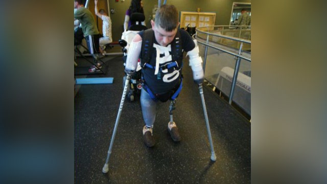 Wounded vet prepares for experimental double arm transplant