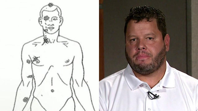 Assistant in private autopsy of Michael Brown speaks out