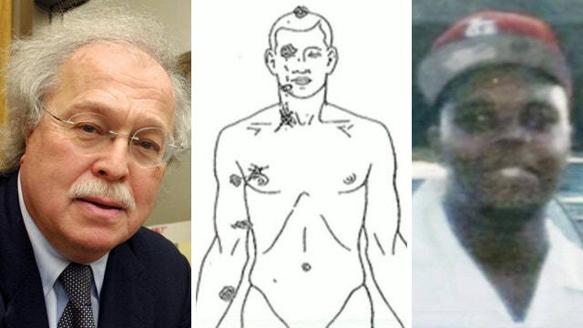Dr. Baden explains his Michael Brown autopsy findings