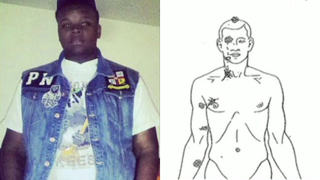 Battle of the autopsies in Michael Brown shooting