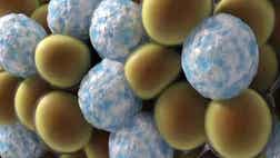 >Tech Take: Clayton Morris demos new CoolSculpting technique, a non-surgical procedure that freezes and dissolves fat in your body