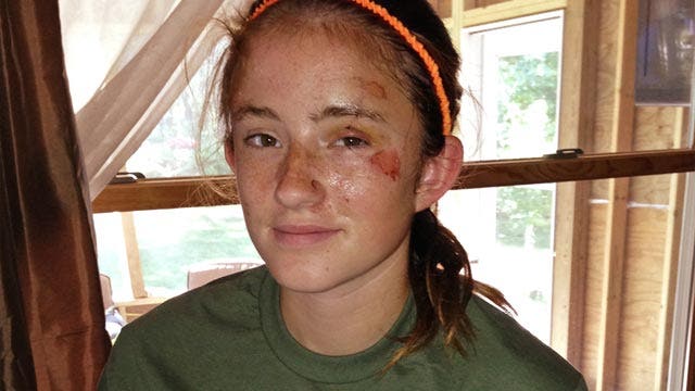 12-year-old girl survives bear attack by playing dead