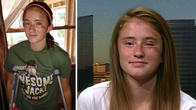 Mich. girl recalls terrifying bear attack