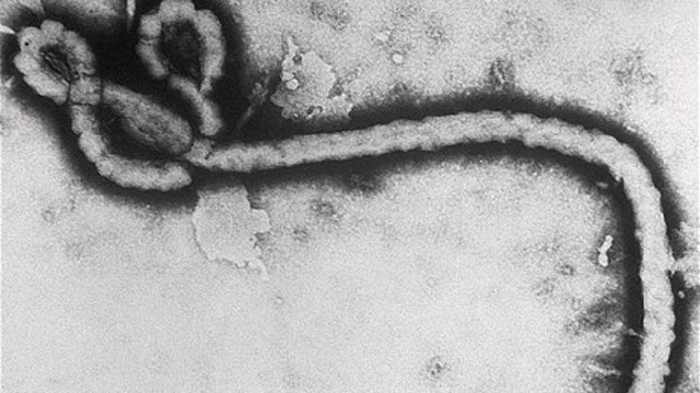 California woman being tested for possible Ebola exposure