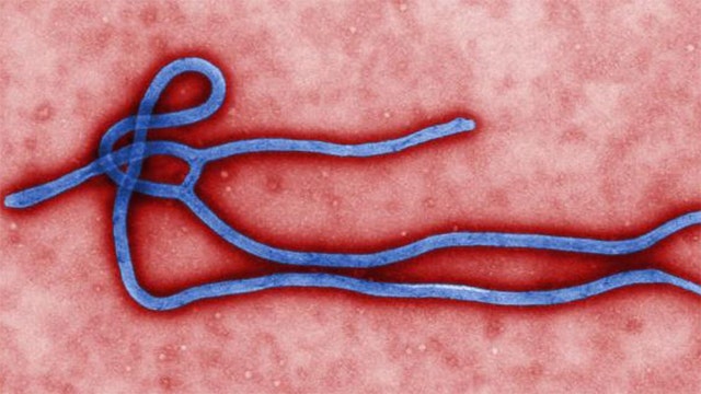 Another American missionary contracts Ebola virus in Liberia