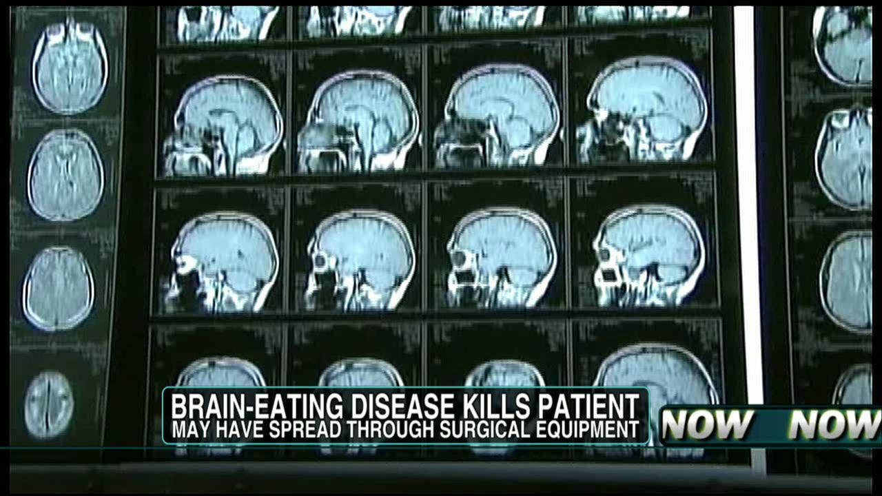 Rare Brain Disorders List