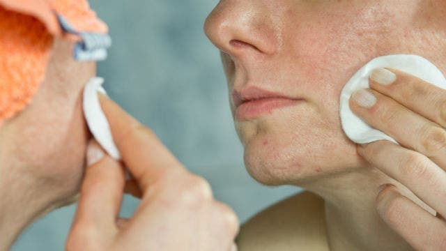 FDA issues warning for popular acne products - Fox News