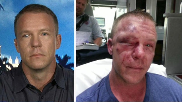 Former Marine badly beaten for standing up to bullies
