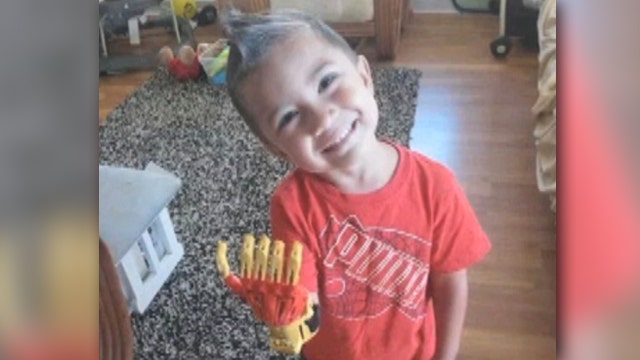 Boy fitted with 3D-printed prosthetic 'Iron Man' hand