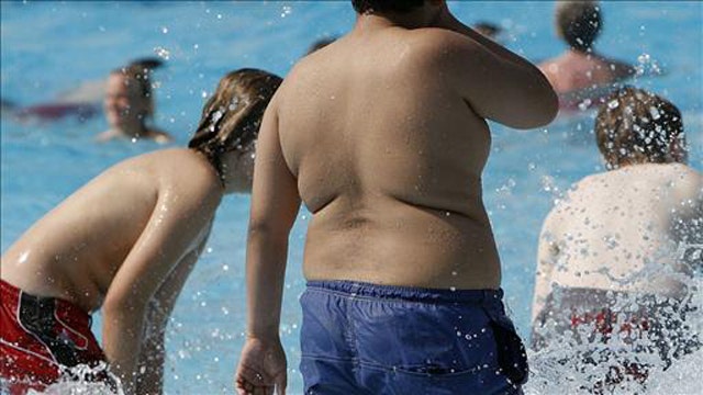 Report: 5 percent of US kids, teens are 'severely obese'