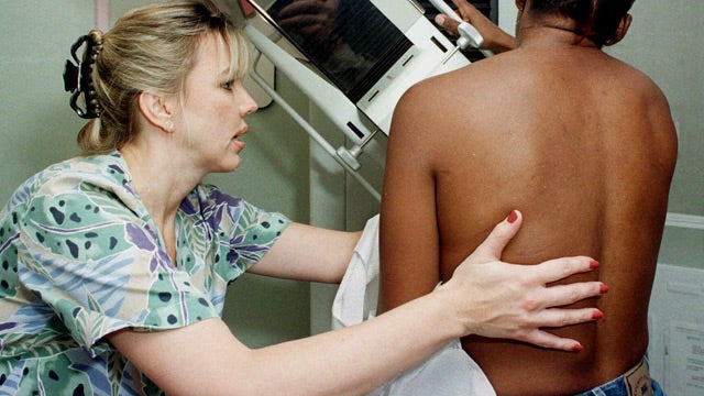 New study suggests need for earlier mammograms