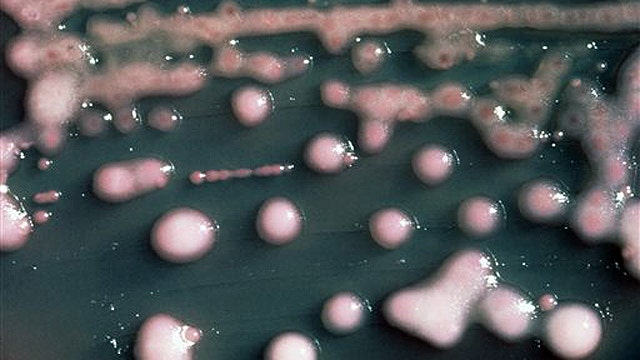 How can we stop the spread of drug-resistant bacteria?
