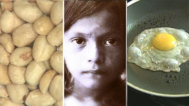 High price tag for kids' food allergies