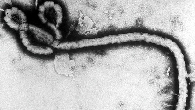 Heated Debate Over Us Preparedness For Ebola Cases Fox News Video