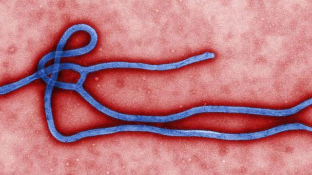 Kansas man isolated after showing Ebola symptoms