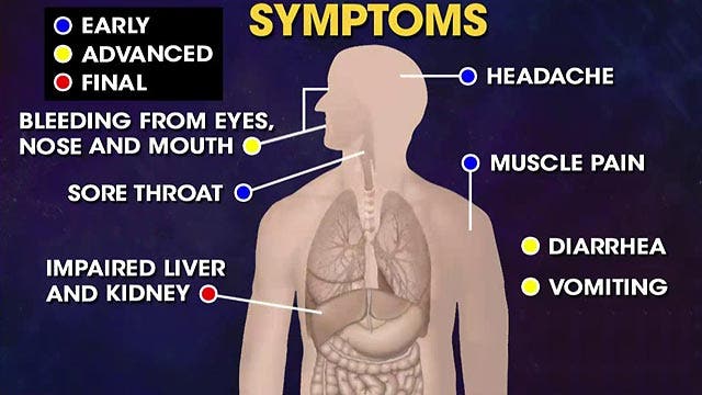 Looking at what Ebola does to the human body