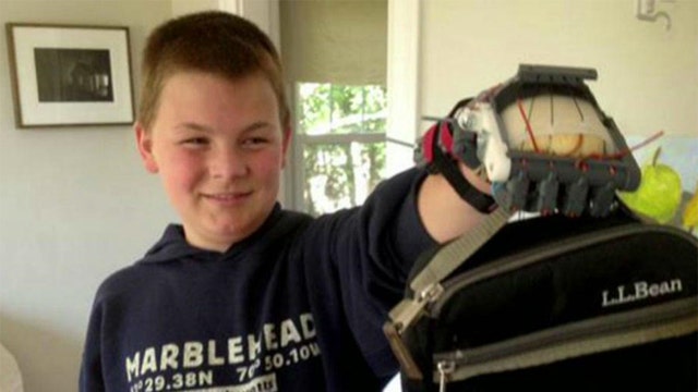 Father makes son's prosthetic hand with 3D printer
