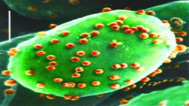 Scientists say they've stumbled upon 'stupidity virus' - Fox News