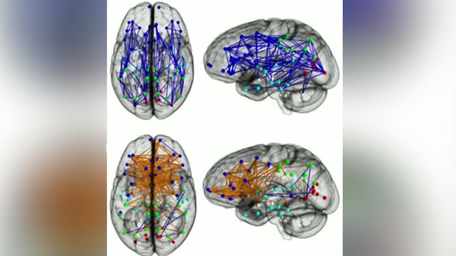 Study reveals male, female brains wired differently 