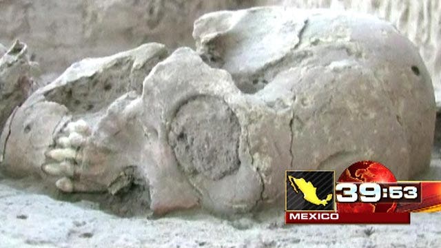 Around the World: Dozen misshaped skulls found in Mexico