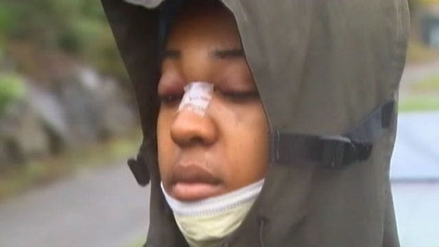Glasses stop bullet, save teen's life