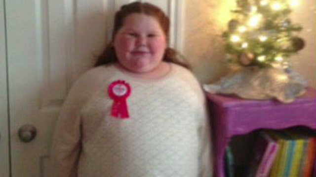 Obese girl denied weight loss surgery for rare illness