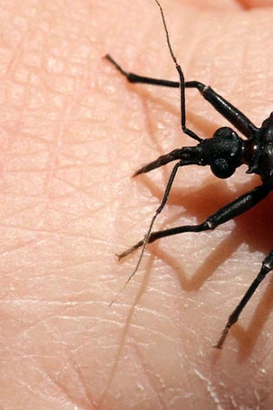 Girl bitten by 'kissing bug' is state's first