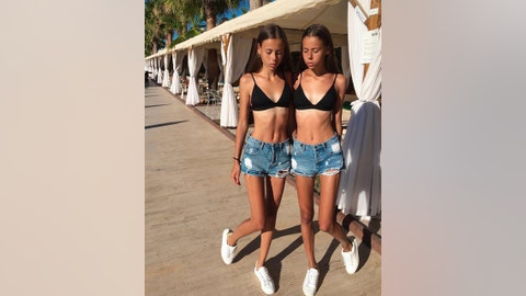 Anorexic sisters hospitalized after modeling agency tells them to 'lose weight so their cheekbones were visible’