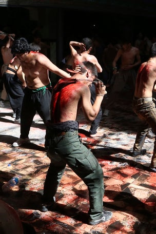 Mystery infections to blood-shedding ritual