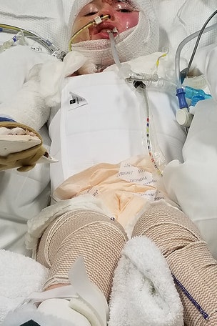Girl's life 'altered forever' after accident
