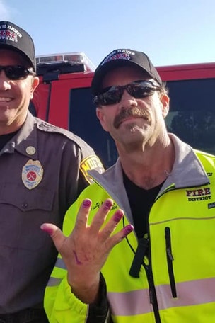 Why firefighter's hands look like this