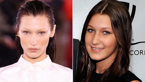 Yolanda Hadid faces backlash for allowing supermodel daughter Bella to get a nose job at age 14