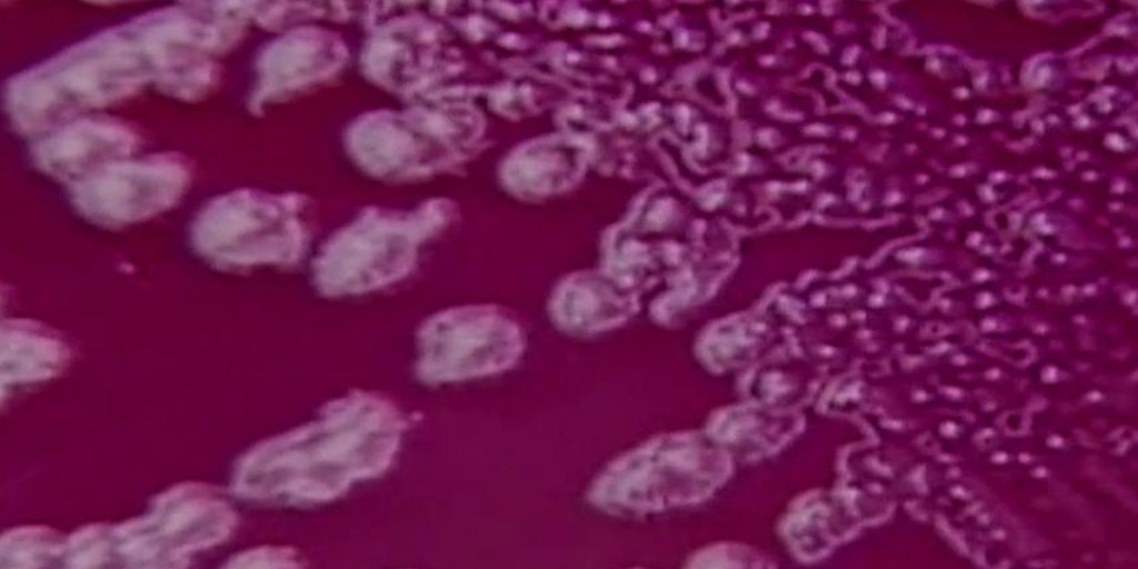The return of the plague in Colorado Fox Business Video