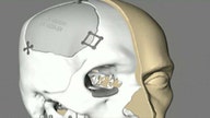 The Expanding Applications of 3D Printing