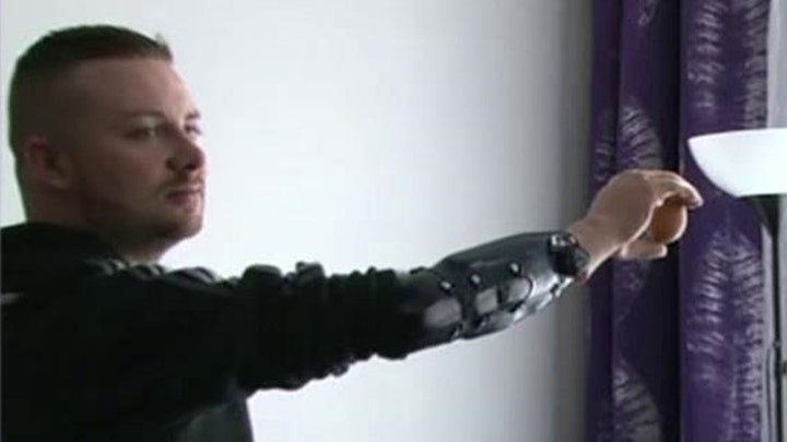 Bionic limbs become reality