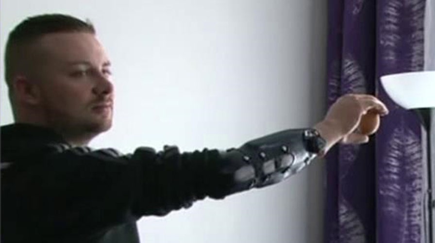 Bionic limbs become reality