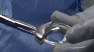 New implant may reduce knee replacements - Fox News
