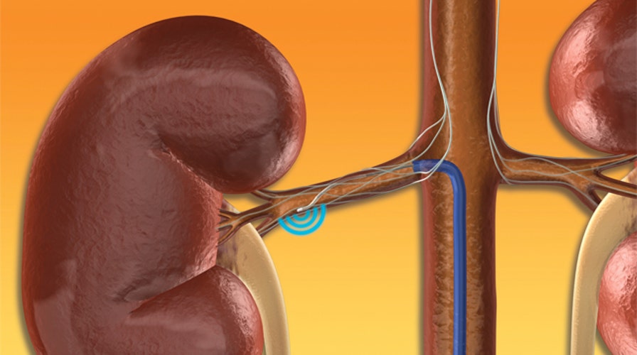 New push to reduce kidney-related deaths worldwide
