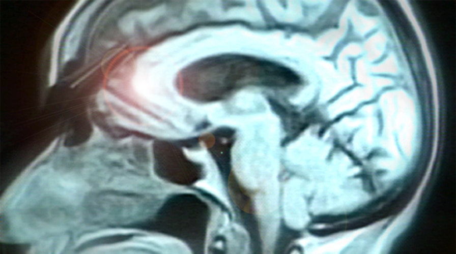 Is a brain hemorrhage preventable?