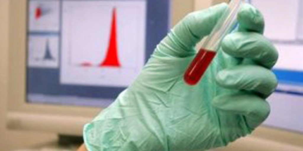 High potassium levels Should I Worry? Fox News Video