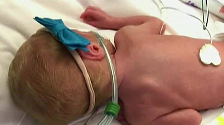 First set of all-girl quintuplets born in the US
