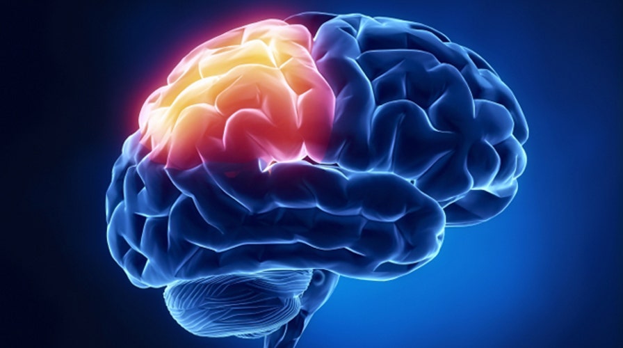 Brain health: Is my memory normal?