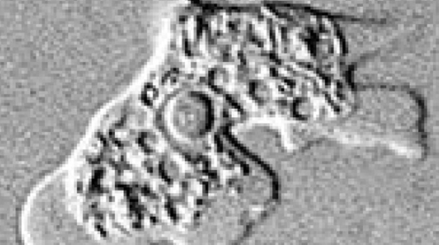 California woman dies after contracting brain-eating amoeba