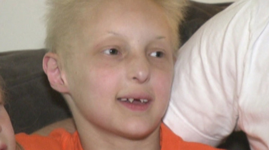 Sizzling summer heat poses challenge for boy who can't sweat