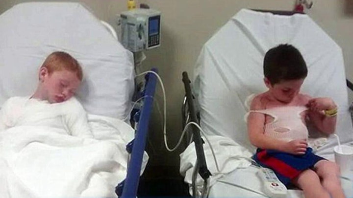 Brothers hospitalized with sunburn after daycare trip