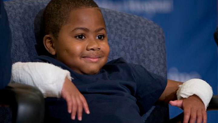 World's first double-hand transplant on a child