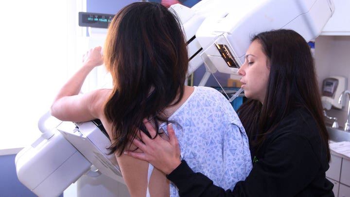 Mammogram guidelines changed by American Cancer Society
