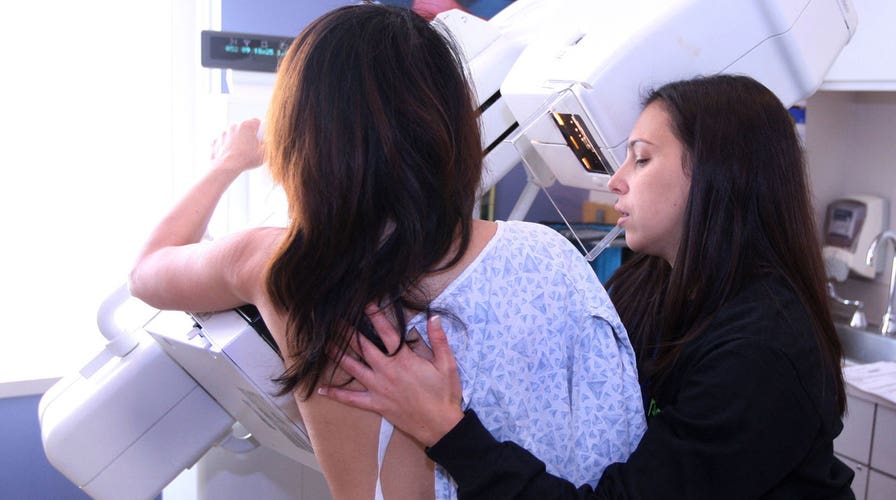 Mammogram guidelines changed by American Cancer Society